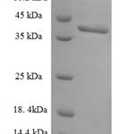 SDS-PAGE separation of QP7374 followed by commassie total protein stain results in a primary band consistent with reported data for U2 small nuclear ribonucleoprotein B''. These data demonstrate Greater than 90% as determined by SDS-PAGE.