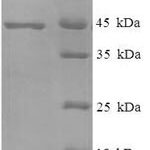 SDS-PAGE separation of QP7383 followed by commassie total protein stain results in a primary band consistent with reported data for MPT51 / MPB51 antigen. These data demonstrate Greater than 90% as determined by SDS-PAGE.