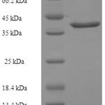 SDS-PAGE separation of QP7386 followed by commassie total protein stain results in a primary band consistent with reported data for Cytidylate kinase. These data demonstrate Greater than 90% as determined by SDS-PAGE.