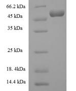 SDS-PAGE separation of QP7399 followed by commassie total protein stain results in a primary band consistent with reported data for Complement C3. These data demonstrate Greater than 80% as determined by SDS-PAGE.