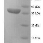 SDS-PAGE separation of QP7403 followed by commassie total protein stain results in a primary band consistent with reported data for H2-D1. These data demonstrate Greater than 90% as determined by SDS-PAGE.