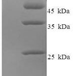 SDS-PAGE separation of QP7407 followed by commassie total protein stain results in a primary band consistent with reported data for Minor capsid protein L2. These data demonstrate Greater than 90% as determined by SDS-PAGE.