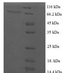 SDS-PAGE separation of QP7408 followed by commassie total protein stain results in a primary band consistent with reported data for Regulatory protein E2. These data demonstrate Greater than 90% as determined by SDS-PAGE.