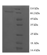 SDS-PAGE separation of QP7408 followed by commassie total protein stain results in a primary band consistent with reported data for Regulatory protein E2. These data demonstrate Greater than 90% as determined by SDS-PAGE.