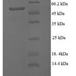 SDS-PAGE separation of QP7415 followed by commassie total protein stain results in a primary band consistent with reported data for Modification methylase EcoRV. These data demonstrate Greater than 90% as determined by SDS-PAGE.