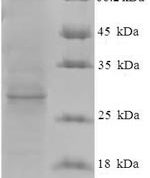 SDS-PAGE separation of QP7492 followed by commassie total protein stain results in a primary band consistent with reported data for Protein ORF3. These data demonstrate Greater than 90% as determined by SDS-PAGE.