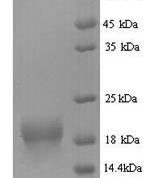 SDS-PAGE separation of QP7503 followed by commassie total protein stain results in a primary band consistent with reported data for Fragile histidine triad / FHIT. These data demonstrate Greater than 90% as determined by SDS-PAGE.