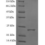 SDS-PAGE separation of QP7508 followed by commassie total protein stain results in a primary band consistent with reported data for S-ribosylhomocysteine lyase. These data demonstrate Greater than 90% as determined by SDS-PAGE.