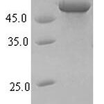 SDS-PAGE separation of QP7521 followed by commassie total protein stain results in a primary band consistent with reported data for Influenza A H1N1 (strain A / Hickox / 1940) Hemagglutinin. These data demonstrate Greater than 90% as determined by SDS-PAGE.