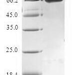 SDS-PAGE separation of QP7523 followed by commassie total protein stain results in a primary band consistent with reported data for Tropomodulin-4. These data demonstrate Greater than 80% as determined by SDS-PAGE.