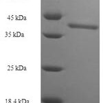 SDS-PAGE separation of QP7535 followed by commassie total protein stain results in a primary band consistent with reported data for Protein SSX2. These data demonstrate Greater than 90% as determined by SDS-PAGE.