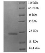 SDS-PAGE separation of QP7536 followed by commassie total protein stain results in a primary band consistent with reported data for CCL14 / HCC-1 / HCC-3. These data demonstrate Greater than 90% as determined by SDS-PAGE.