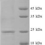 SDS-PAGE separation of QP7537 followed by commassie total protein stain results in a primary band consistent with reported data for Guanylate cyclase activator 2B. These data demonstrate Greater than 90% as determined by SDS-PAGE.