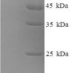 SDS-PAGE separation of QP7542 followed by commassie total protein stain results in a primary band consistent with reported data for Caprin-1. These data demonstrate Greater than 90% as determined by SDS-PAGE.