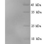 SDS-PAGE separation of QP7546 followed by commassie total protein stain results in a primary band consistent with reported data for Ubiquitin-like protein SMT3. These data demonstrate Greater than 90% as determined by SDS-PAGE.