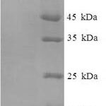 SDS-PAGE separation of QP7561 followed by commassie total protein stain results in a primary band consistent with reported data for Nucleolar GTP-binding protein 2. These data demonstrate Greater than 90% as determined by SDS-PAGE.