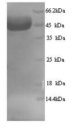 SDS-PAGE separation of QP7562 followed by commassie total protein stain results in a primary band consistent with reported data for Myosin-binding protein C