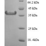 SDS-PAGE separation of QP7568 followed by commassie total protein stain results in a primary band consistent with reported data for MAD2L1 / MAD2. These data demonstrate Greater than 90% as determined by SDS-PAGE.