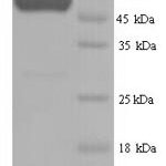 SDS-PAGE separation of QP7576 followed by commassie total protein stain results in a primary band consistent with reported data for Septin-7. These data demonstrate Greater than 90% as determined by SDS-PAGE.