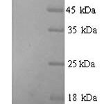 SDS-PAGE separation of QP7596 followed by commassie total protein stain results in a primary band consistent with reported data for Glucokinase regulatory protein. These data demonstrate Greater than 80% as determined by SDS-PAGE.