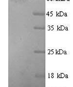 SDS-PAGE separation of QP7596 followed by commassie total protein stain results in a primary band consistent with reported data for Glucokinase regulatory protein. These data demonstrate Greater than 80% as determined by SDS-PAGE.