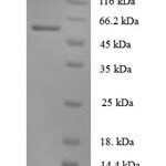 SDS-PAGE separation of QP7600 followed by commassie total protein stain results in a primary band consistent with reported data for Angiopoietin 1 / ANG1 / ANGPT1. These data demonstrate Greater than 90% as determined by SDS-PAGE.