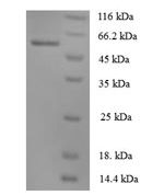 SDS-PAGE separation of QP7600 followed by commassie total protein stain results in a primary band consistent with reported data for Angiopoietin 1 / ANG1 / ANGPT1. These data demonstrate Greater than 90% as determined by SDS-PAGE.
