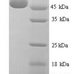 SDS-PAGE separation of QP7604 followed by commassie total protein stain results in a primary band consistent with reported data for Hyaluronidase-1. These data demonstrate Greater than 90% as determined by SDS-PAGE.