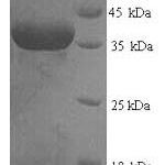 SDS-PAGE separation of QP7616 followed by commassie total protein stain results in a primary band consistent with reported data for SART3. These data demonstrate Greater than 90% as determined by SDS-PAGE.