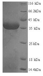 SDS-PAGE separation of QP7616 followed by commassie total protein stain results in a primary band consistent with reported data for SART3. These data demonstrate Greater than 90% as determined by SDS-PAGE.