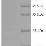 SDS-PAGE separation of QP7621 followed by commassie total protein stain results in a primary band consistent with reported data for Serine / threonine-protein kinase STK11. These data demonstrate Greater than 90% as determined by SDS-PAGE.