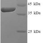 SDS-PAGE separation of QP7632 followed by commassie total protein stain results in a primary band consistent with reported data for IZUMO4 / C19orf36. These data demonstrate Greater than 90% as determined by SDS-PAGE.