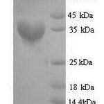 SDS-PAGE separation of QP7663 followed by commassie total protein stain results in a primary band consistent with reported data for fabD. These data demonstrate Greater than 90% as determined by SDS-PAGE.