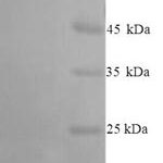 SDS-PAGE separation of QP7674 followed by commassie total protein stain results in a primary band consistent with reported data for NAALADL2. These data demonstrate Greater than 90% as determined by SDS-PAGE.