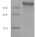 SDS-PAGE separation of QP7687 followed by commassie total protein stain results in a primary band consistent with reported data for Influenza A H2N2 (strain A / Korea / 426 / 1968) Hemagglutinin. These data demonstrate Greater than 90% as determined by SDS-PAGE.