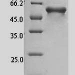 SDS-PAGE separation of QP7689 followed by commassie total protein stain results in a primary band consistent with reported data for Mucosal addressin cell adhesion molecule 1. These data demonstrate Greater than 90% as determined by SDS-PAGE.