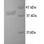 SDS-PAGE separation of QP7690 followed by commassie total protein stain results in a primary band consistent with reported data for Tyrosine-protein kinase JAK3. These data demonstrate Greater than 90% as determined by SDS-PAGE.