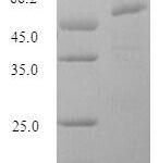 SDS-PAGE separation of QP7702 followed by commassie total protein stain results in a primary band consistent with reported data for Influenza A H2N2 (strain A / Mallard / New York / 6750 / 1978) Hemagglutinin. These data demonstrate Greater than 90% as determined by SDS-PAGE.