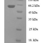 SDS-PAGE separation of QP7704 followed by commassie total protein stain results in a primary band consistent with reported data for TBCEL. These data demonstrate Greater than 90% as determined by SDS-PAGE.