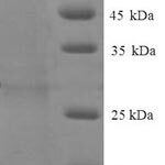 SDS-PAGE separation of QP7716 followed by commassie total protein stain results in a primary band consistent with reported data for BEN domain-containing protein 3. These data demonstrate Greater than 90% as determined by SDS-PAGE.