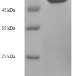 SDS-PAGE separation of QP7717 followed by commassie total protein stain results in a primary band consistent with reported data for 2-oxoglutarate dehydrogenase