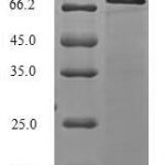 SDS-PAGE separation of QP7725 followed by commassie total protein stain results in a primary band consistent with reported data for E3 ubiquitin-protein ligase TRIM21. These data demonstrate Greater than 90% as determined by SDS-PAGE.