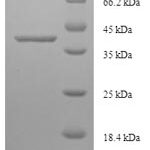 SDS-PAGE separation of QP7726 followed by commassie total protein stain results in a primary band consistent with reported data for La-related protein 1B. These data demonstrate Greater than 90% as determined by SDS-PAGE.