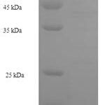 SDS-PAGE separation of QP7749 followed by commassie total protein stain results in a primary band consistent with reported data for Leucine-rich repeat neuronal protein 1. These data demonstrate Greater than 90% as determined by SDS-PAGE.