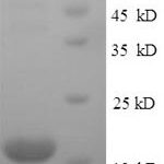 SDS-PAGE separation of QP7756 followed by commassie total protein stain results in a primary band consistent with reported data for ILDR2. These data demonstrate Greater than 90% as determined by SDS-PAGE.