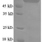 SDS-PAGE separation of QP7772 followed by commassie total protein stain results in a primary band consistent with reported data for Adck2. These data demonstrate Greater than 90% as determined by SDS-PAGE.