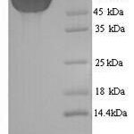 SDS-PAGE separation of QP7778 followed by commassie total protein stain results in a primary band consistent with reported data for Cytokeratin