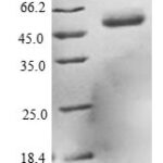 SDS-PAGE separation of QP7792 followed by commassie total protein stain results in a primary band consistent with reported data for DCXR / HCR2. These data demonstrate Greater than 80% as determined by SDS-PAGE.