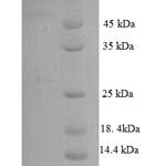 SDS-PAGE separation of QP7804 followed by commassie total protein stain results in a primary band consistent with reported data for Wdpcp. These data demonstrate Greater than 90% as determined by SDS-PAGE.