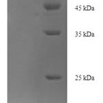 SDS-PAGE separation of QP7816 followed by commassie total protein stain results in a primary band consistent with reported data for Oxysterol-binding protein-related protein 11. These data demonstrate Greater than 90% as determined by SDS-PAGE.